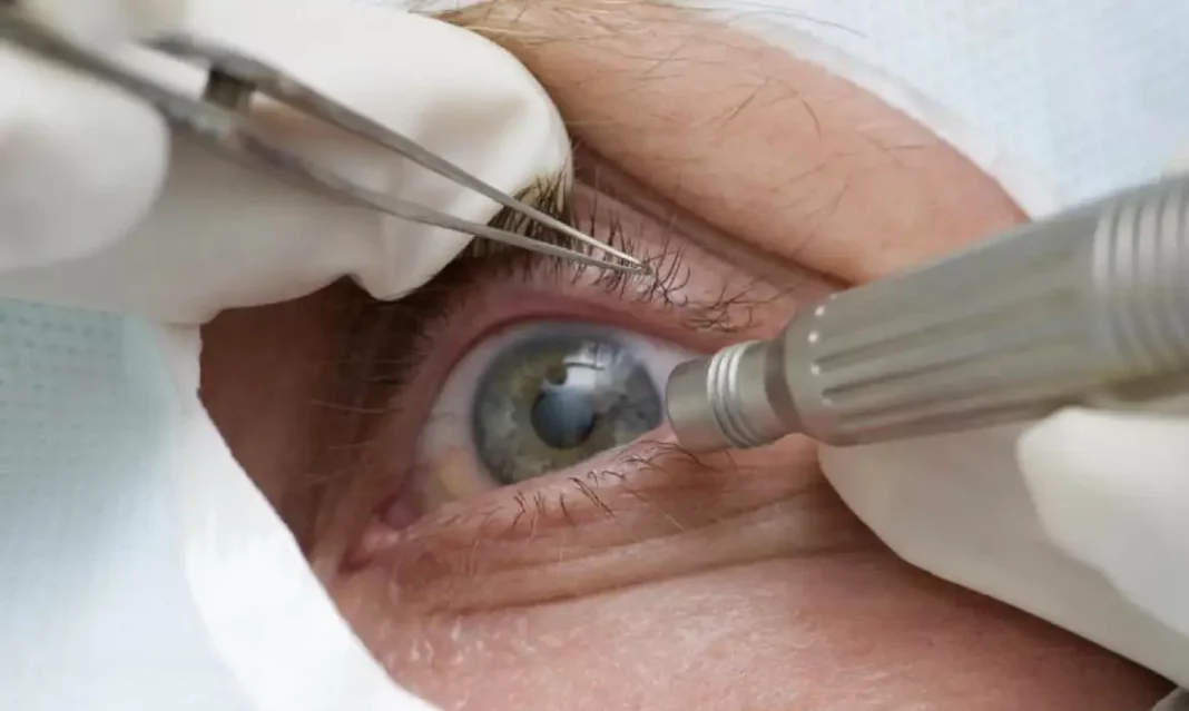 Médicos alertam para riscos de cirurgia de mudança da cor dos olhos | Foto: Pref de Três Barras SC/Divulgação