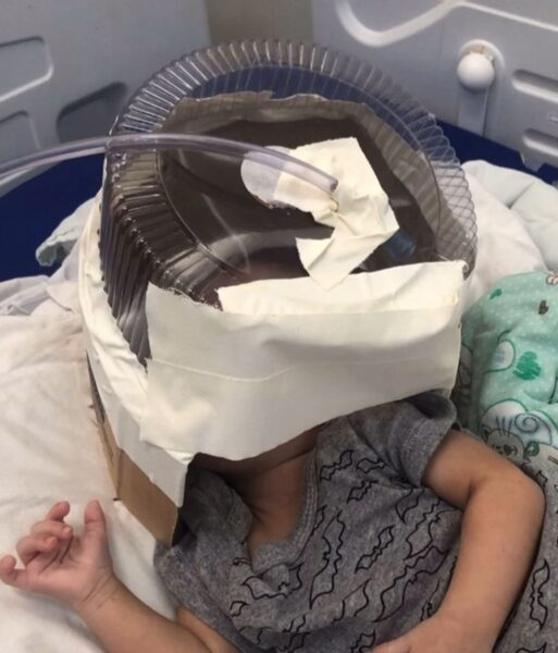 Hospital usou embalagem de bolo como máscara de oxigênio durante internação do bebê — Foto: Reprodução