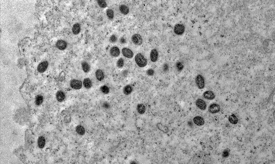 Mpox. Foto: Débora F. Barreto-Vieira/IOC/Fiocruz