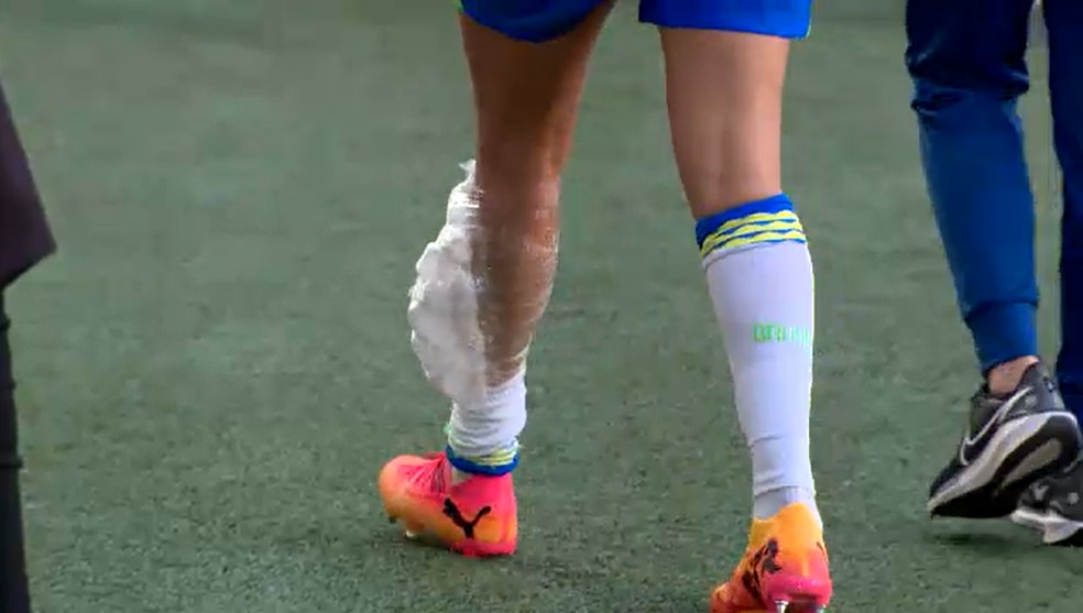 Antonia deixa gramado com gelo na perna lesionada — Foto: Rafael Carneiro/ ge.globo
