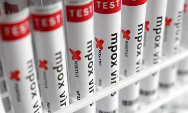 Test tubes labelled